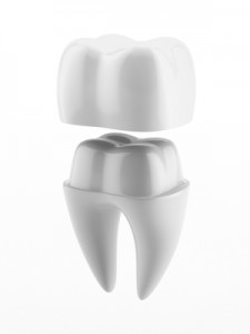 dental crown and tooth